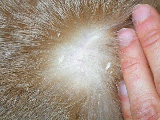 Выпадения волос у девушек: причины, лечение выпадения волос на голове у девушек - клиника хфе в москве