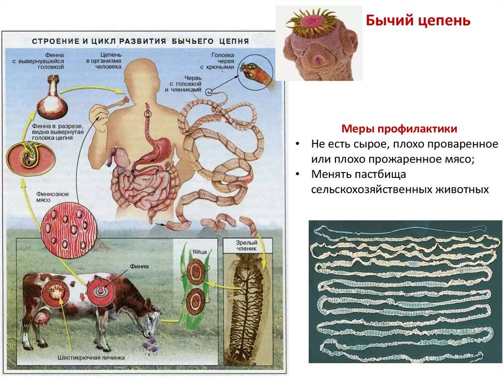 12 ветеринарно-санитарная экспертиза туш и органов животных при инвазионных заболеваниях, передающихся и не передающихся человеку через мясо и мясопродукты